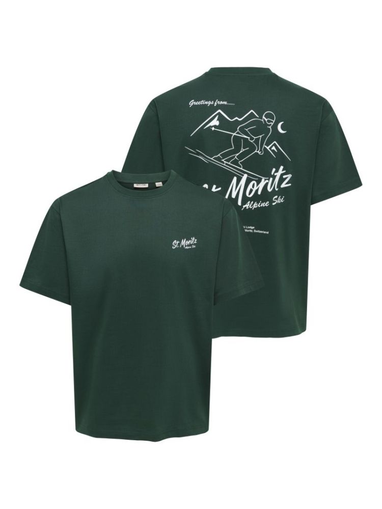 ONSFRED LIFE RLX SS PRINT TEE 206190034 Pine