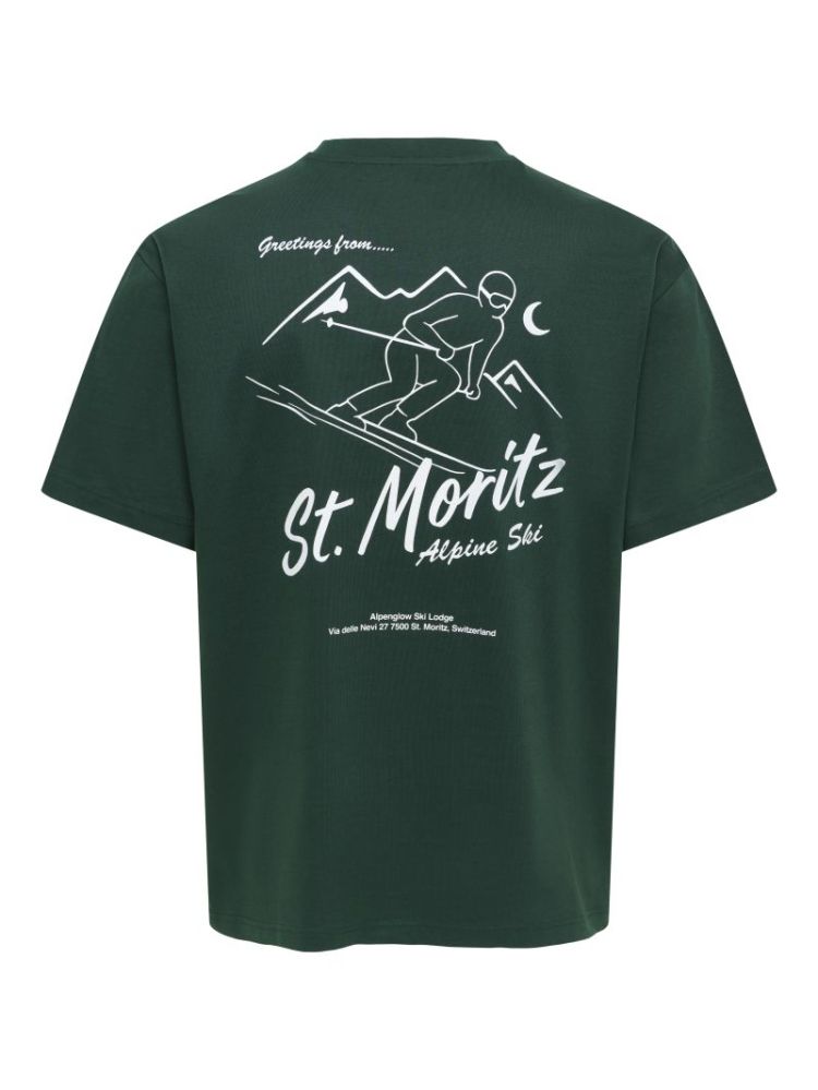 ONSFRED LIFE RLX SS PRINT TEE 206190034 Pine